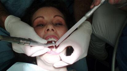 Pene inasprite per i dentisti abusivi, Aio plaude al DDl Lorenzin