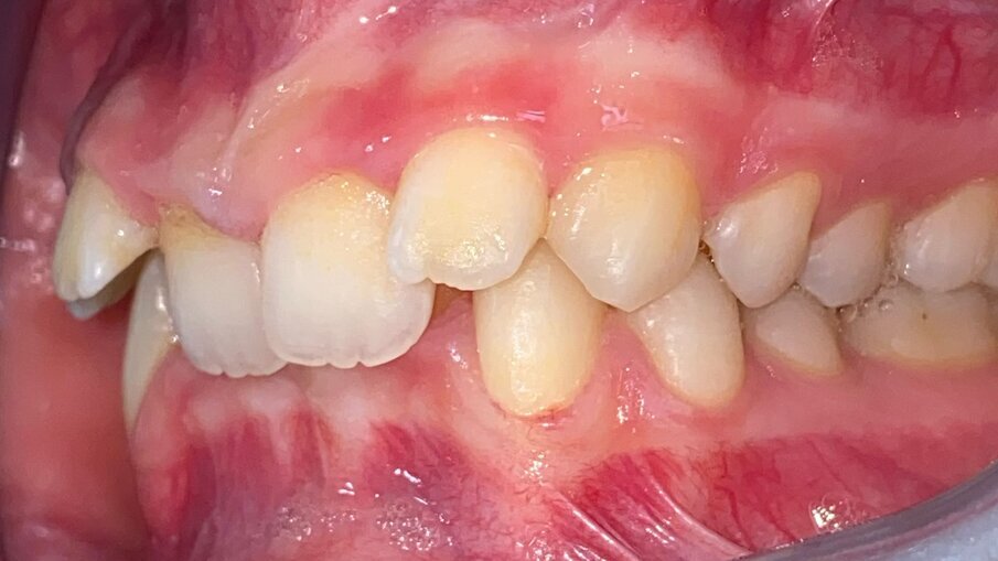 Fig. 7_Laterale sinistra pre-trattamento.