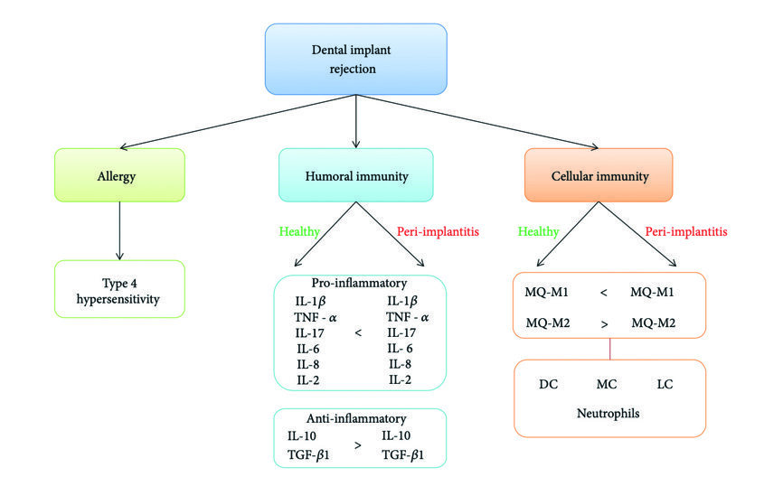 Fig. 2 : Synthèse de l’échec d’un implant dentaire lié au système immunitaire vu sous trois aspects : immunité cellulaire et humorale et réactions allergiques