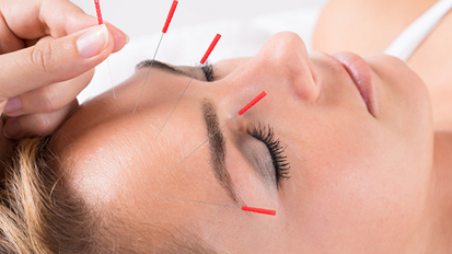 Mit Akupunktur gegen die Zahnarztangst Mit Akupunktur gegen die Zahnarztangst