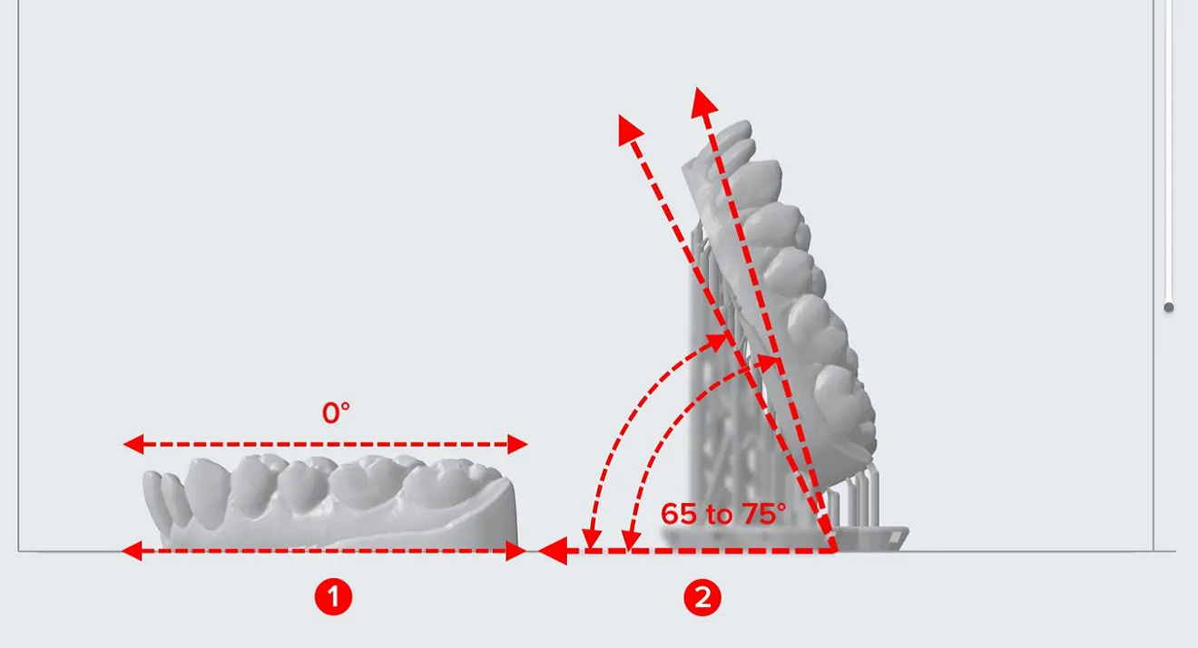 Fig. 2: Design of a model for clear aligner and retainer production printed horizontally with the base directly on the build platform or vertically with supports.