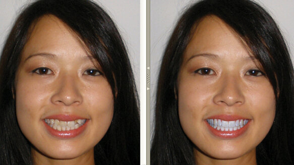 Automate increasing your cosmetic revenue