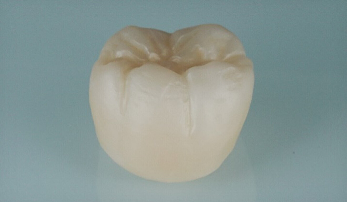 Fig. 1: Sintered and sandblasted zirconia crown. 