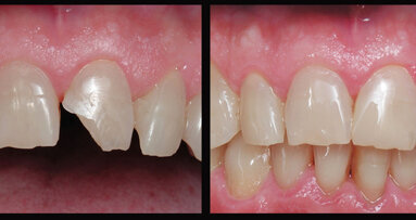 Imitando la naturaleza