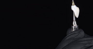 Minimally invasive implant therapy in the anterior zone