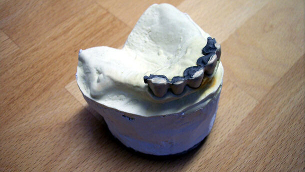 “La questione odontotecnica”: al centro della presentazione e dell’avvio dell’attività del Centro Studi ANTLO