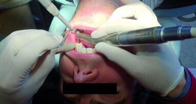 Ces dents qui nous font tourner la tête ! Travailler en vision indirecte ?