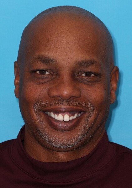 Fig. 1: Full-face view of the patient.