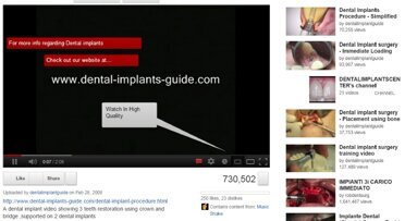 Ocenjen je kvalitet video-sadržaja namenjenih stomatolozima na Jutjubu