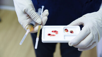 Jetzt online: Neue Themenseite „Eigenblutkonzentrate (PRF)“ Jetzt online: Neue Themenseite „Eigenblutkonzentrate (PRF)“