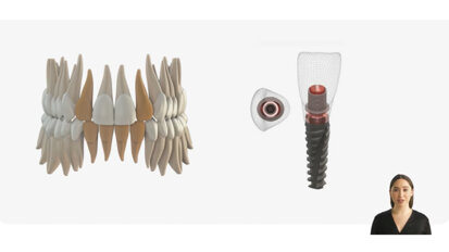 Keystone Dental Group – Genesis Active – Angle Correction Solutions – ELLIPTIBase Conical Connection Abutment