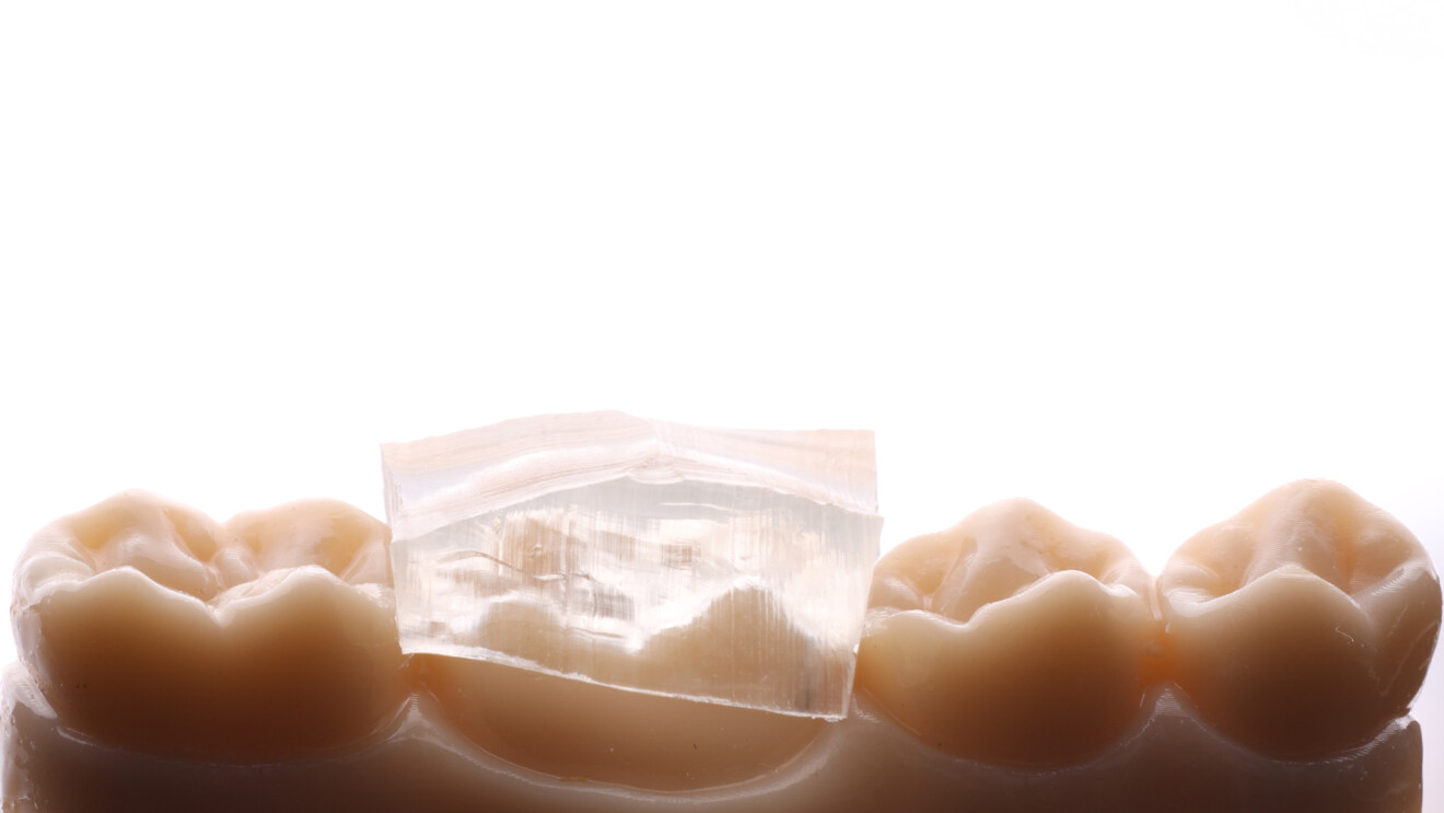 Fig. 12 : Clé en silicone découpée pour la première molaire.