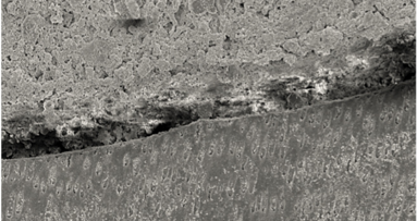 El sellado del complejo dentinopulpar (Primera parte)