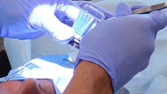 New device detects bacteria during root canal treatment