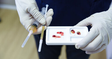 Jetzt online: Neue Themenseite „Eigenblutkonzentrate (PRF)“