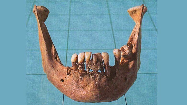 Los “dientes de Waterloo”