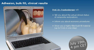 KaVo webinar  ‘Composiet vulsysteem voor posterieure restauraties’