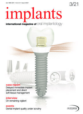 implants international No. 3, 2021 implants international No. 3, 2021