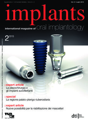implants Italy No. 2, 2013 implants Italy No. 2, 2013