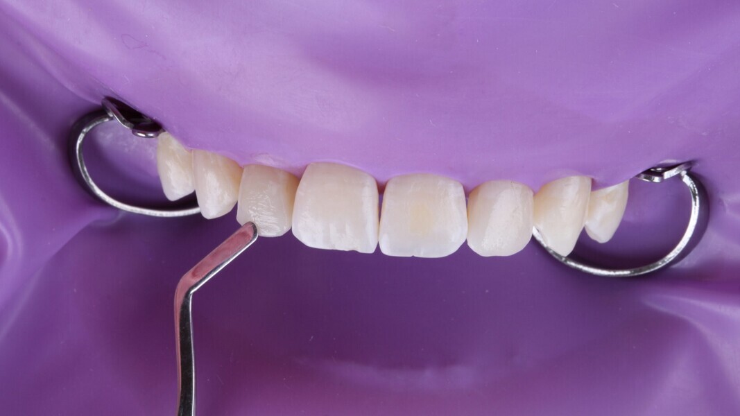 Fig. 11: De anatomie van element #12 vormen.
