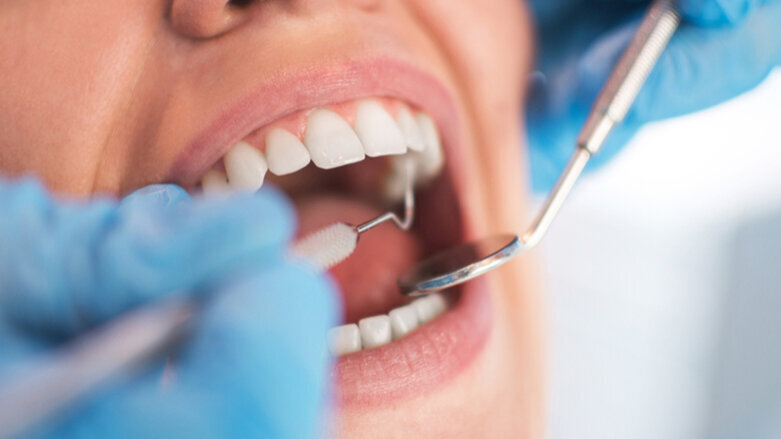 Surprising dental health inequalities found between foreign‐ and UK‐born adults