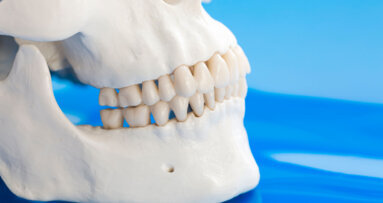 Orthopaedic treatment in Class II cases—clinical considerations