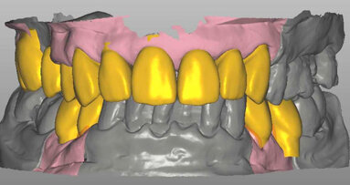Odontoiatria estetica: il paziente protagonista della sinergia tra odontoiatra e odontotecnico