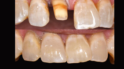 Un delicado juego de luces y colores