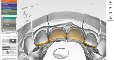 Estetická rehabilitace a zachovávání tkání ve frontálním úseku chrupu