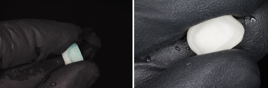 Figs 24A-B: Conditioning the glass-ceramic components 