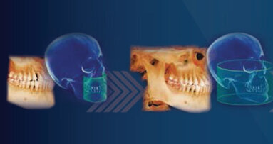 i-CAT FLX V-Series: A CBCT solution that can grow with your practice