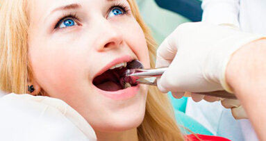 In Australia costano milioni le estrazioni di terzi molari non necessarie