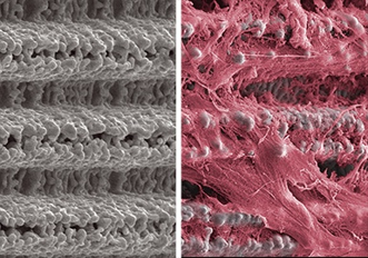 Laser-Lok® Laser-Lok®