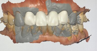 传统牙医的数字化转型：掌握关键的十大要点”