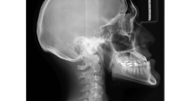 Nascholing stralingsbescherming voor hele team voor één bedrag per jaar