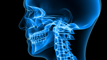 Nach Unfall: Teenager kann Kiefer wieder bewegen