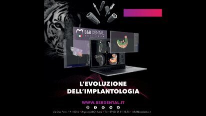 Chirurgia guidata B&B Dental Aspetti pratici e vantaggi