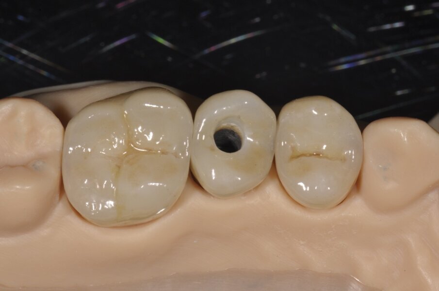 Fig. 13 - Il restauro al termine della lavorazione e dopo le varie prove interlocutorie consegnate sul modello ottenuto per fresaggio.