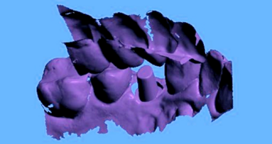 Skanowanie z poziomu implantu – część 2