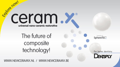 CERAM.X met nieuwe fillertechnologie