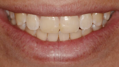 Color y forma: los objetivos de estética