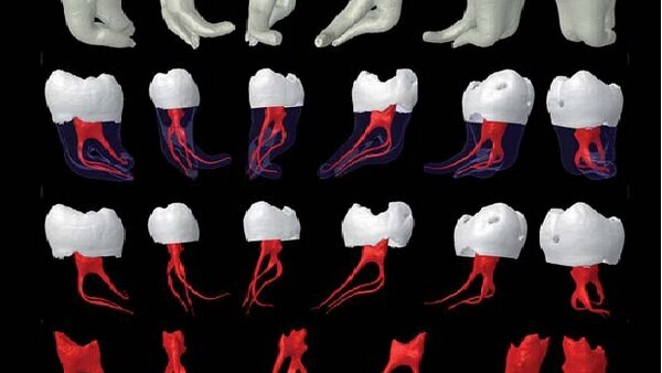 La parusia endodontica. Non parole, ma fatti