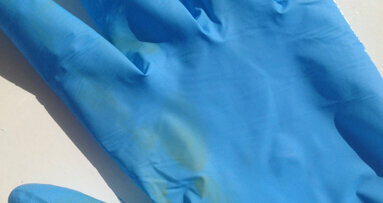 Contactallergie door handschoenen groeiend probleem