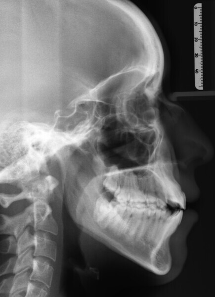 Fig. 6: Lateral radiograph.