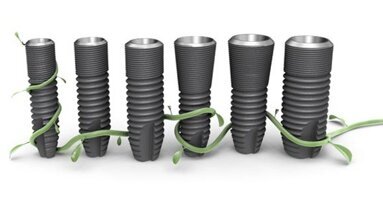 Astra Tech's latest implant system available in the US