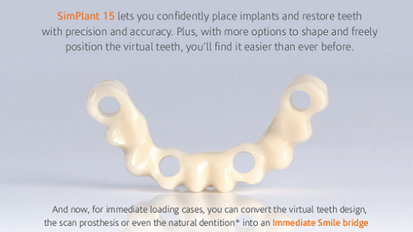 SimPlant® 15 – Maggiore predicibilità della procedura chirurgica e della ricostruzione protesica