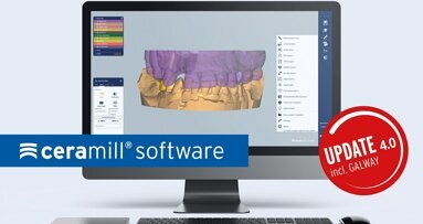 Amann Girrbach optimiert die gesamte Ceramill Software-Familie