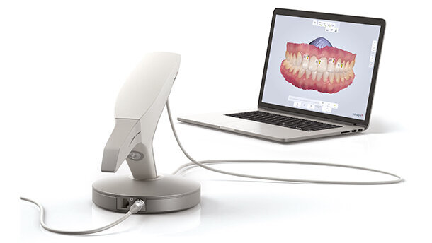 Nuova partnership Neoss e 3Shape