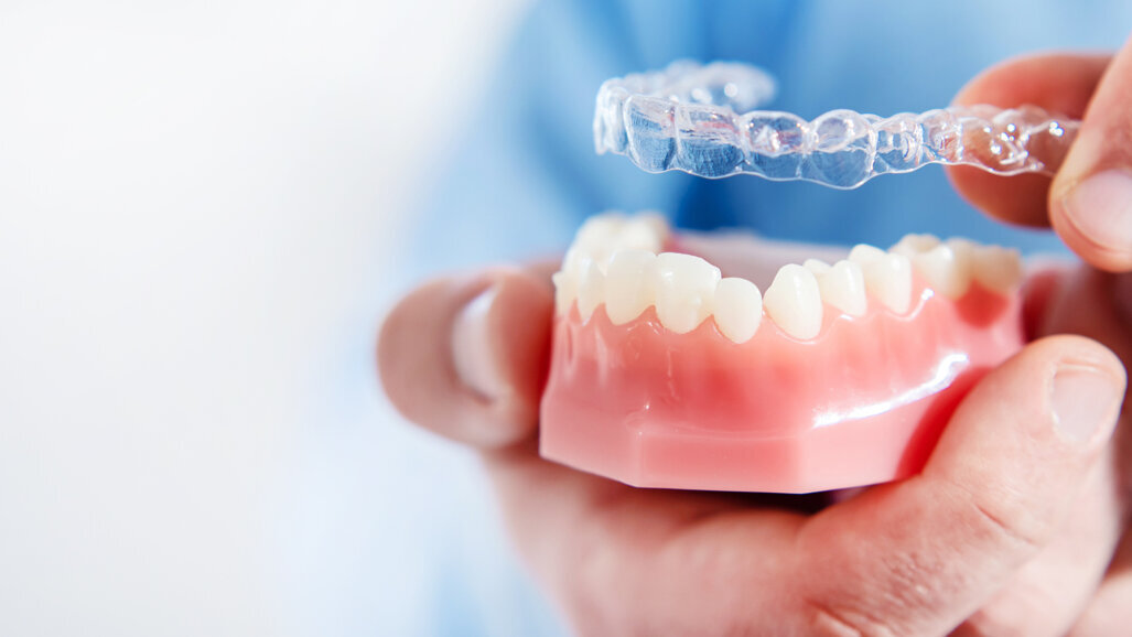 Straumann Group to acquire Berlin clear aligner manufacturer PlusDental