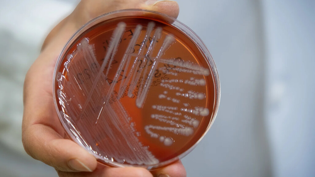 Изследователи от Фрайбург проучват неизвестни орални бактерии свързани с пародонтита